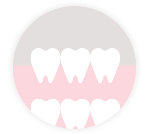 乳歯列期(0～6歳前後)