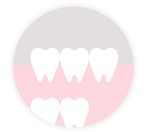 混合歯列期
(6歳前後～12歳前後)