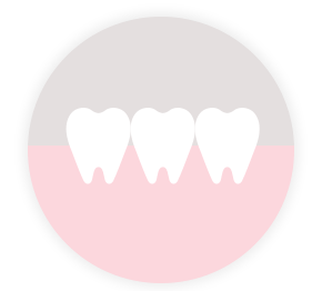 永久歯列期
(12歳前後)